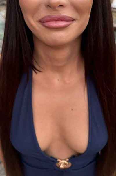 Petra, 38 år